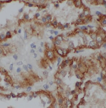 BPHL Rabbit Polyclonal Antibody
