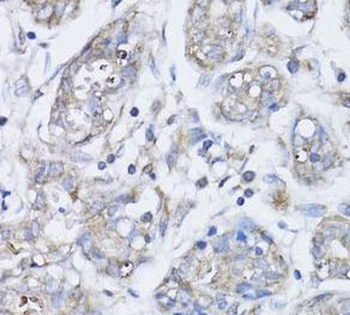BRCA1 Rabbit Polyclonal Antibody