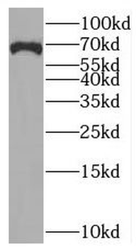 BRCC3 Antibody