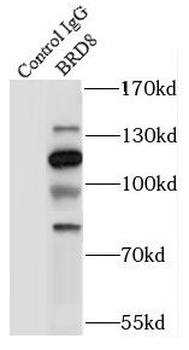 BRD8 Antibody