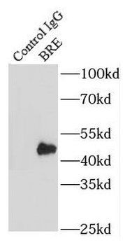 BABAM2 Antibody
