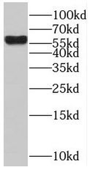 BTBD16 Rabbit Polyclonal Antibody