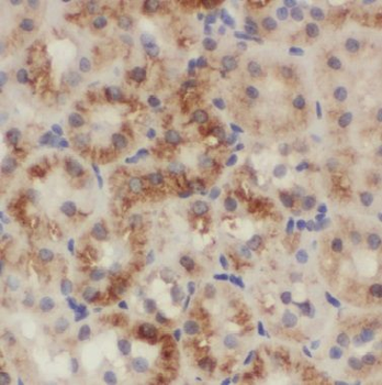 BTBD16 Rabbit Polyclonal Antibody