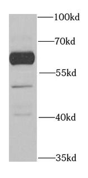 BTD Antibody