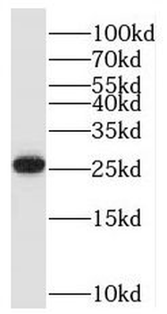 BTG4 Rabbit Polyclonal Antibody