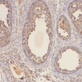 BTG4 Rabbit Polyclonal Antibody