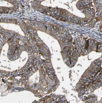 BVES Rabbit Polyclonal Antibody