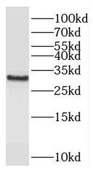 CSTPP1 Rabbit Polyclonal Antibody