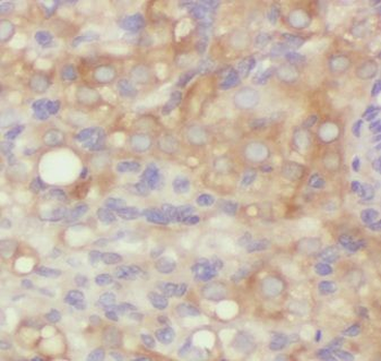 AAMDC Rabbit Polyclonal Antibody