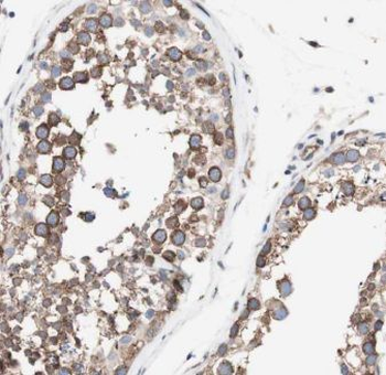 CFAP300 Rabbit Polyclonal Antibody