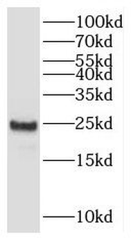 IFTAP Rabbit Polyclonal Antibody