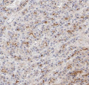 IFTAP Rabbit Polyclonal Antibody