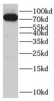 INTS13 Rabbit Polyclonal Antibody