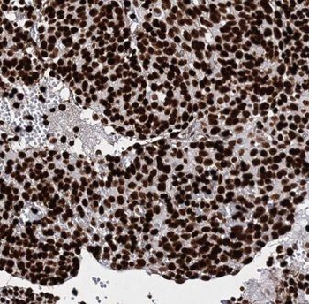 INTS13 Rabbit Polyclonal Antibody