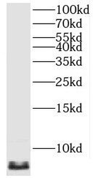 ATP5MJ Rabbit Polyclonal Antibody