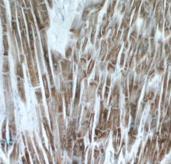 ATP5MJ Rabbit Polyclonal Antibody