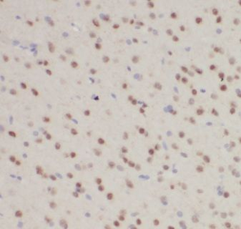 KATNBL1 Rabbit Polyclonal Antibody