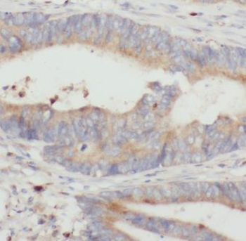 C18orf21 Rabbit Polyclonal Antibody