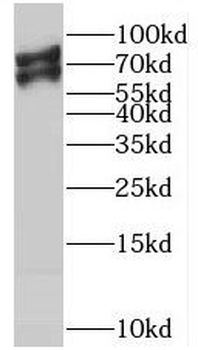 RMC1 Rabbit Polyclonal Antibody