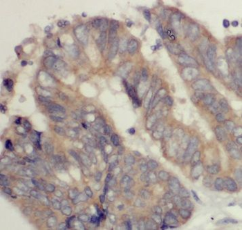 RMC1 Rabbit Polyclonal Antibody
