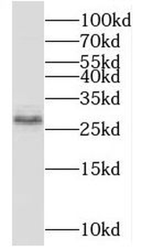 TRIR Rabbit Polyclonal Antibody