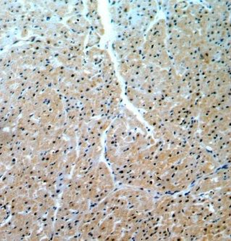 TRIR Rabbit Polyclonal Antibody