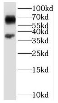 SARG Antibody