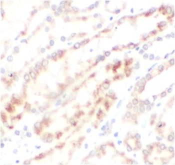 METTL18 Rabbit Polyclonal Antibody