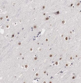 TCEANC2 Rabbit Polyclonal Antibody