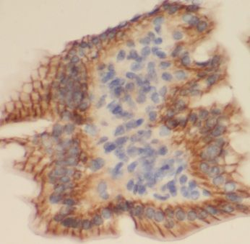 MAIP1 Rabbit Polyclonal Antibody