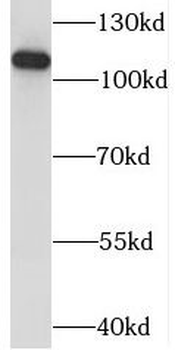 KANSL1L Rabbit Polyclonal Antibody