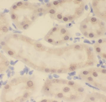 KANSL1L Rabbit Polyclonal Antibody