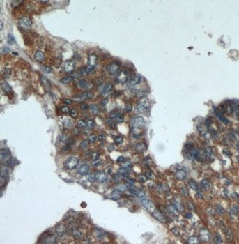 XXYLT1 Rabbit Polyclonal Antibody