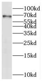 POMGNT2 Rabbit Polyclonal Antibody