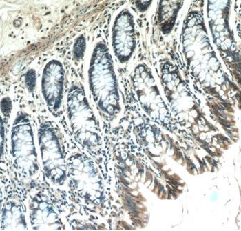 ABHD18 Rabbit Polyclonal Antibody