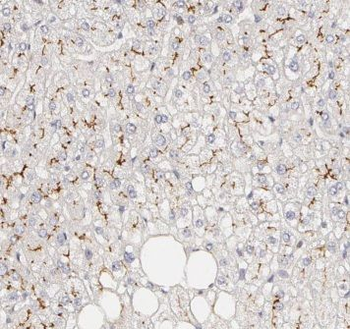 C5AR1 Rabbit Polyclonal Antibody