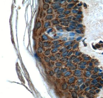 C6orf15 Rabbit Polyclonal Antibody