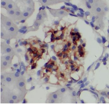 SUGCT Rabbit Polyclonal Antibody