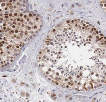 C9orf78 Rabbit Polyclonal Antibody