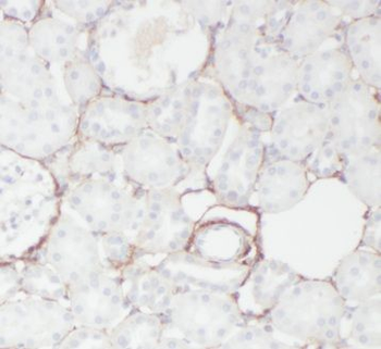 CA9 Rabbit Polyclonal Antibody