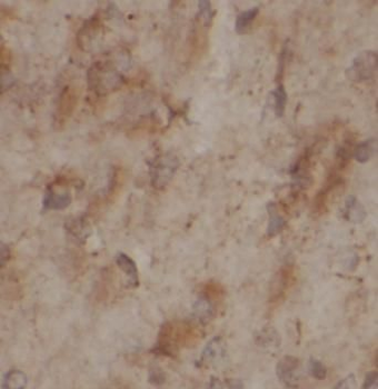 CA11 Rabbit Polyclonal Antibody