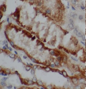 CA12 Rabbit Polyclonal Antibody