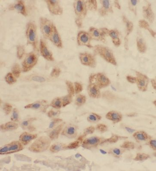 CA13 Rabbit Polyclonal Antibody