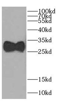 CA7 Antibody