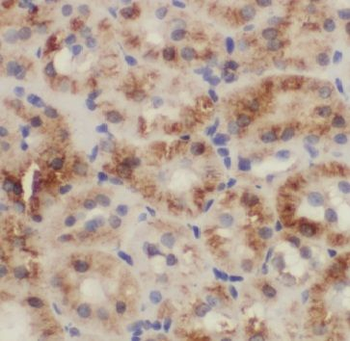 CA7 Rabbit Polyclonal Antibody