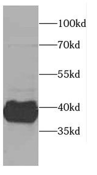 CAB39L Antibody