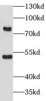 CABYR Antibody