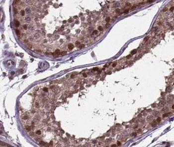 CABYR Rabbit Polyclonal Antibody