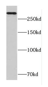 CACNA1B Antibody