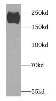 CACNA1S Rabbit Polyclonal Antibody